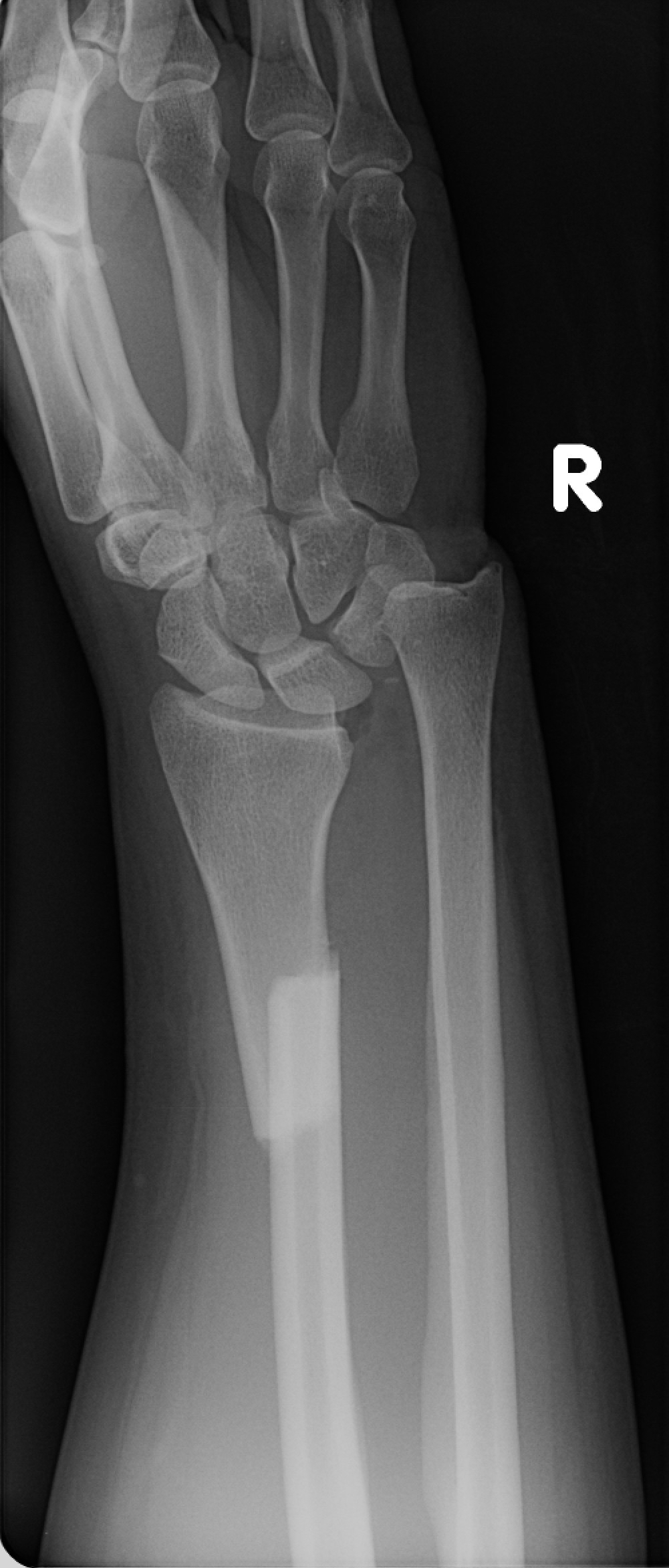 Handgelenk
