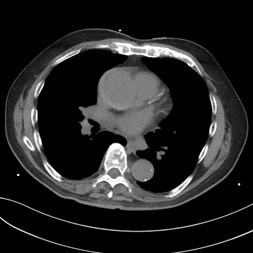 Native CT in axialer Schichtführung
