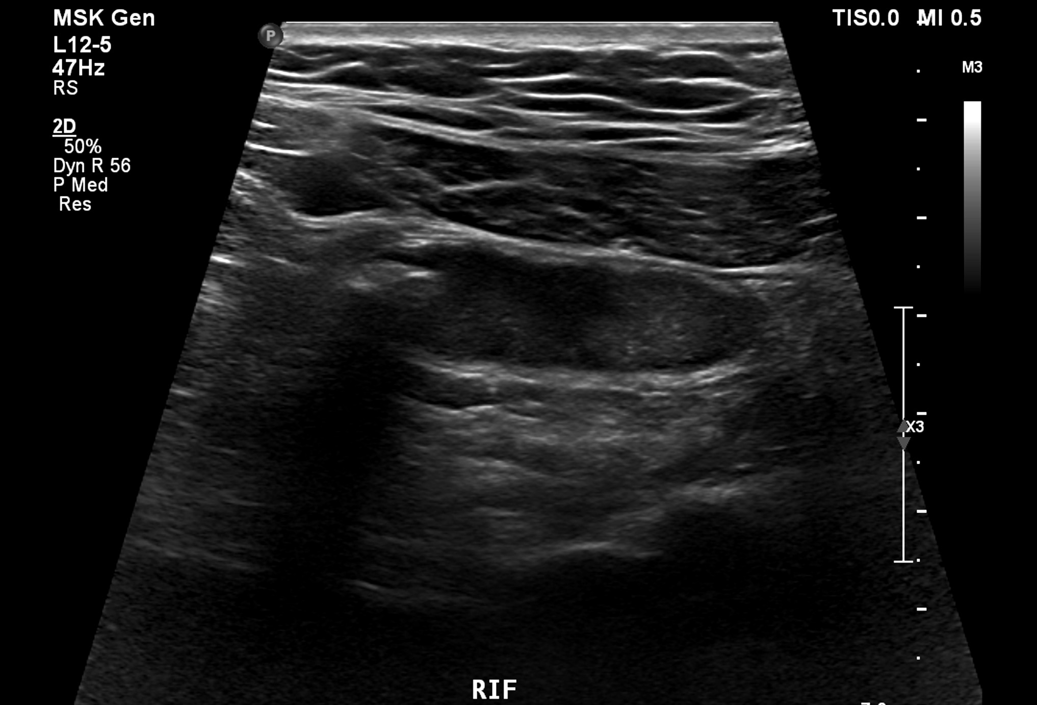 Ultraschall re. Unterbauch