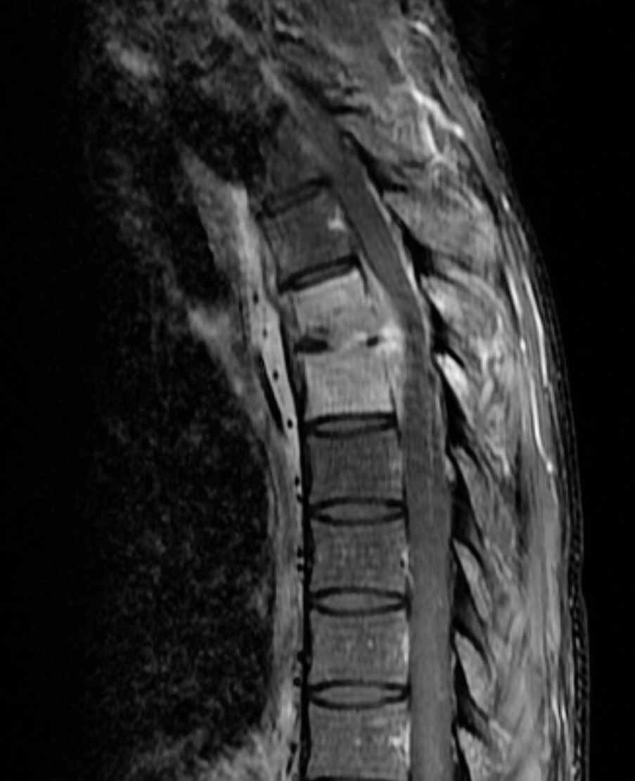 T1w sag mit KM