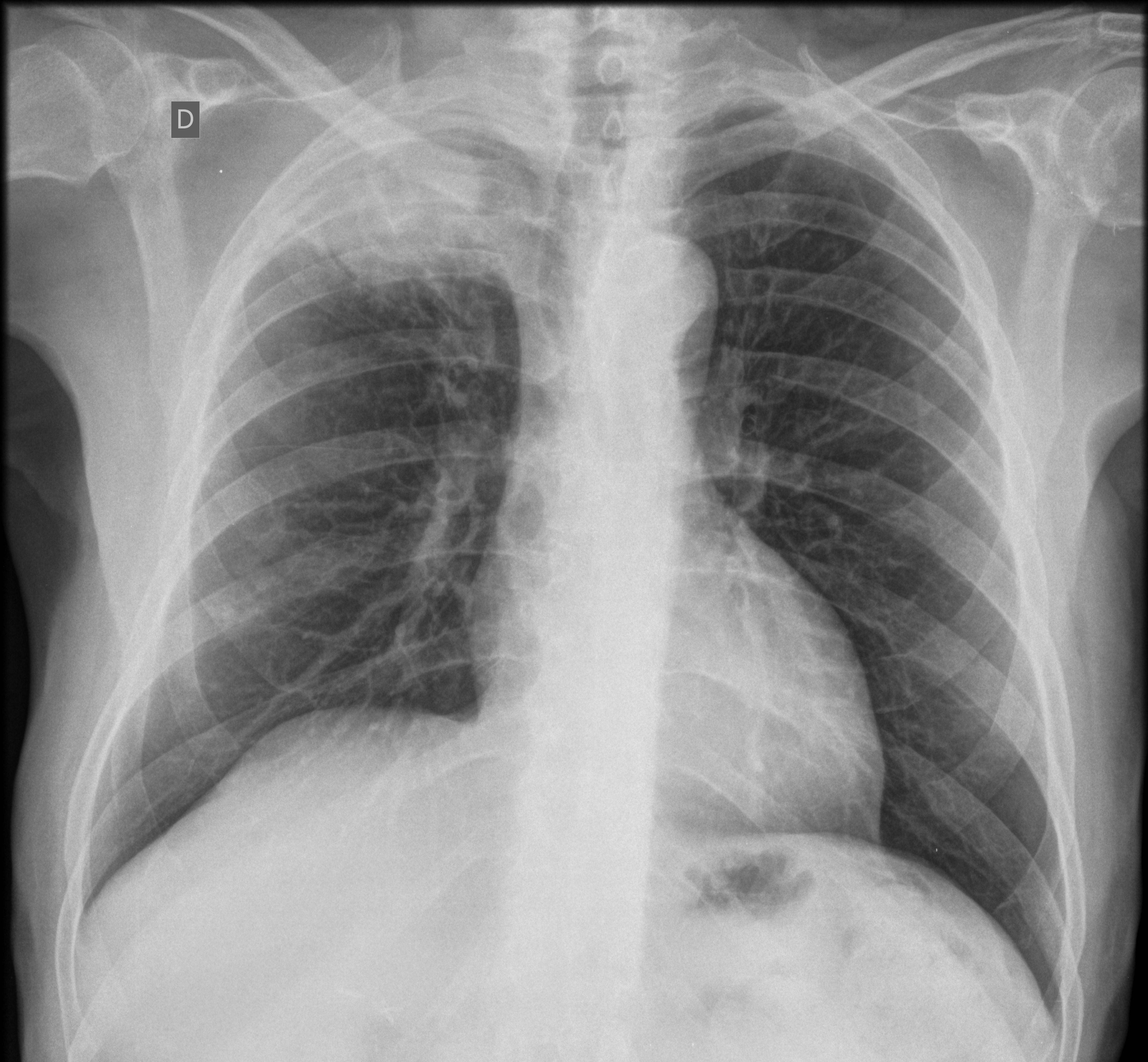 Case courtesy of Bruno Di Muzio rID: 29403