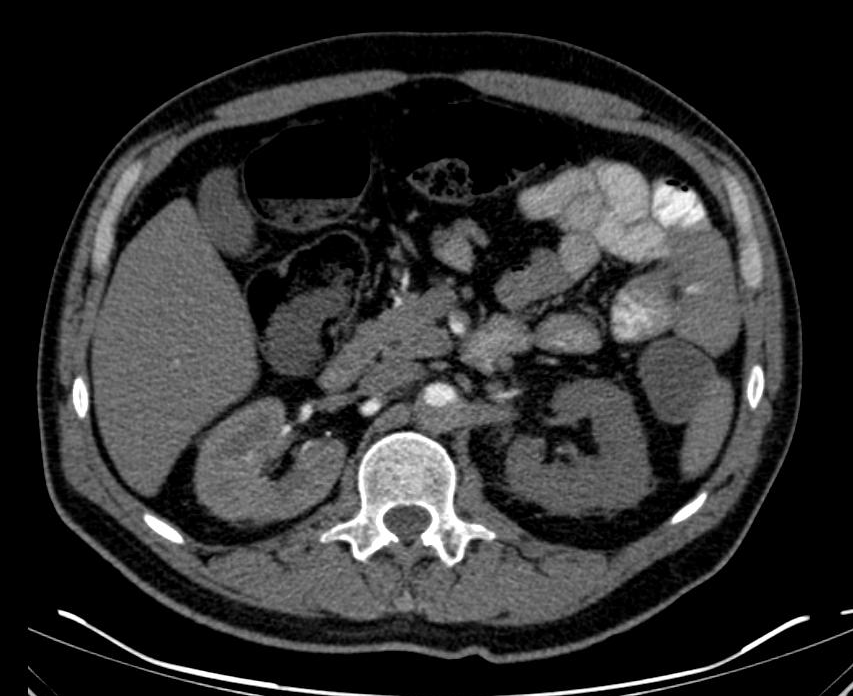 CT-Angiographie