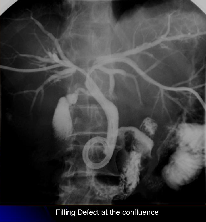 Cholangiografie