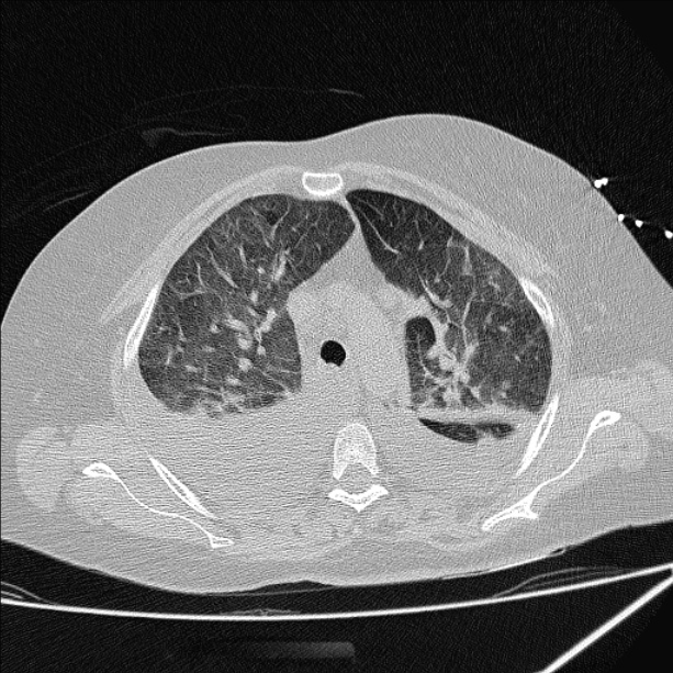 Axiales CT (1)
