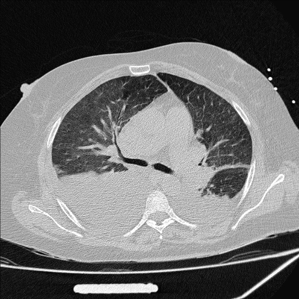 Axiales CT (2)