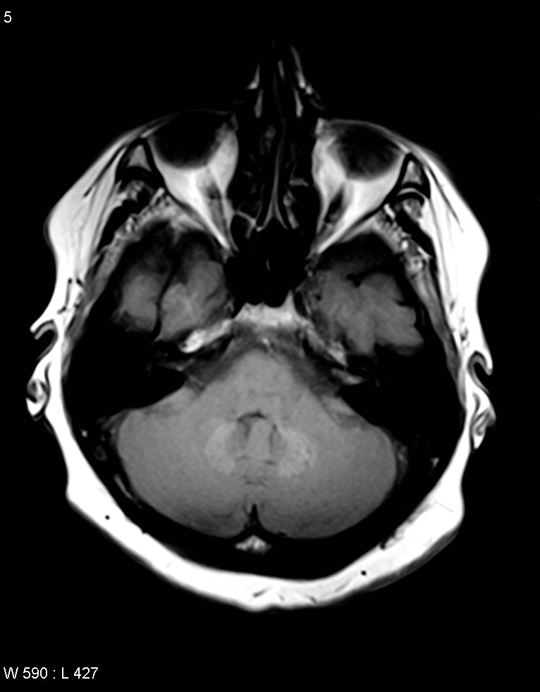 T1w nativ axial