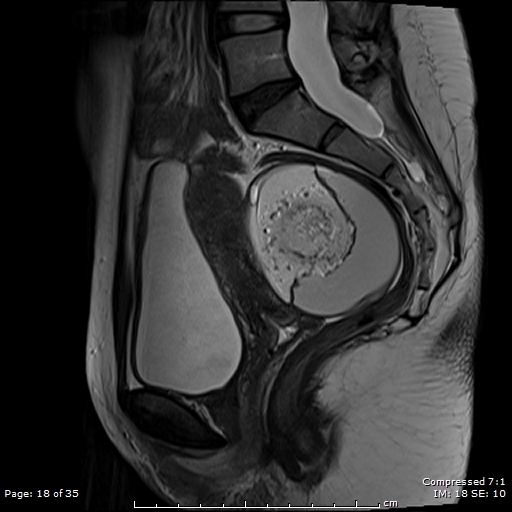 Sagittal